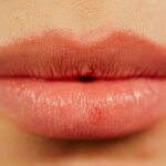 মোটা ঠোঁট চিকন করার উপায়