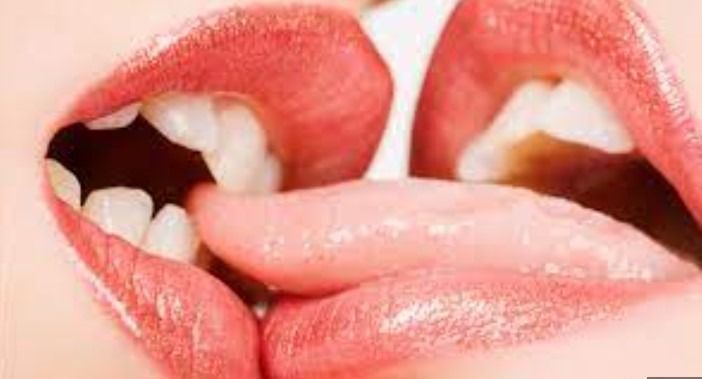 ফ্রেঞ্চ কিস করার নিয়ম